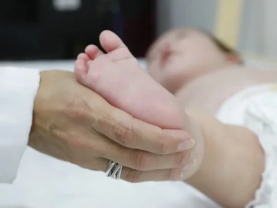 Atraso no teste do pezinho adia diagnóstico e tratamento da AME no Brasil